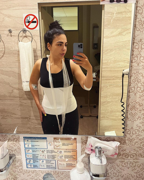 «Мне срезали 5 кг кожи»: блогерша показала фото до и после экстремального похудения
