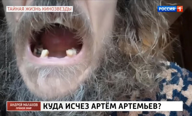 Звезда сериала «Татьянин день» Артем Артемьев: «Меня отравили. Выпали все зубы и волосы»