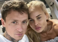 Любовница Павла Мамаева не скрывает пластическую операцию