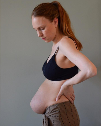 Мама тройни выглядит беременной даже через 3 месяца после родов — фото