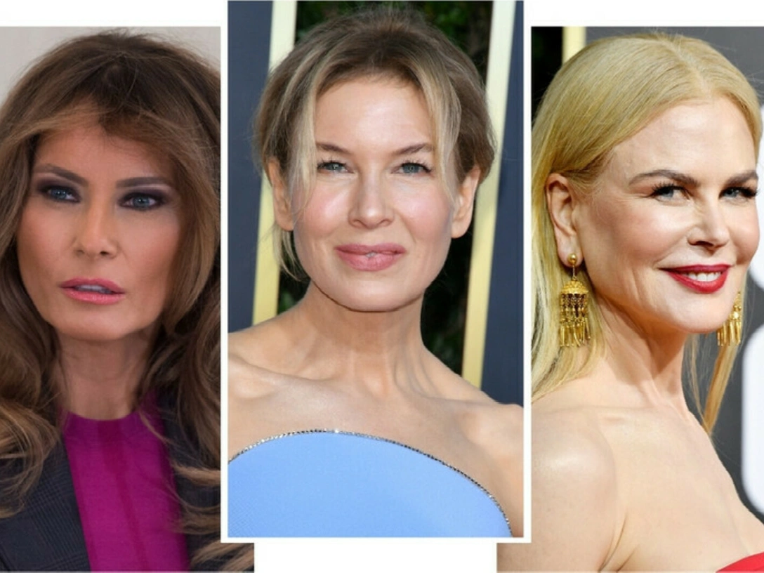 Потерять лицо: звезды, которые переборщили с ботоксом | marieclaire.ru