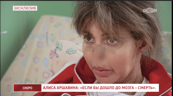 «Ходить не могу, пролежни воспалились»: состояние Алисы Казьминой ухудшилось