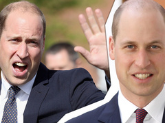 Из-за стремительного облысения 35-летнему принцу Уильяму пришлось сменить прическу