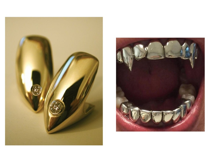 Клыки, бриллианты и неоновые виниры: 4 сумасшедших украшения для зубов
