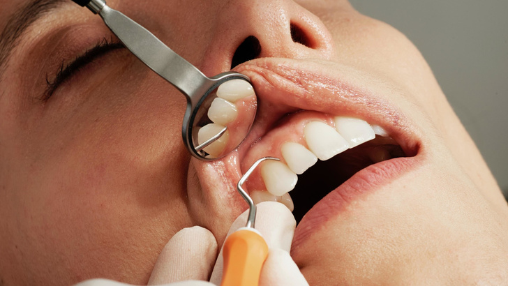 Как наше психологическое состояние влияет на зубы