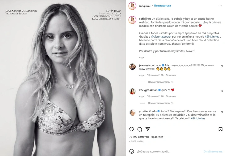 Первый ангел Victoria's Secret с синдромом Дауна: как модель выглядела в детстве