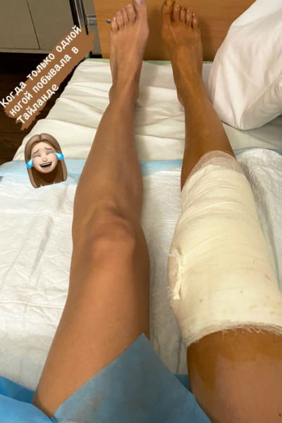 Евгения Лоза перенесла операцию на колене