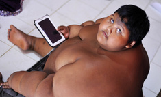 Осталась половина: самый полный ребенок в мире похудел на 100 кг