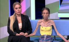 «Организм съел все мышцы и кожу»: в 27 лет жительница Белгорода весит всего 20 кг
