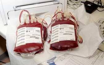 Что будет, если поменять группу крови? Рассказывает врач