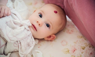 гемангиома | Источник: iStockphoto/martinedoucet