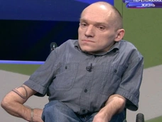 «Родителям сказали поставить меня в сервант и забыть»: как живет мужчина, ломавший кости 300 раз
