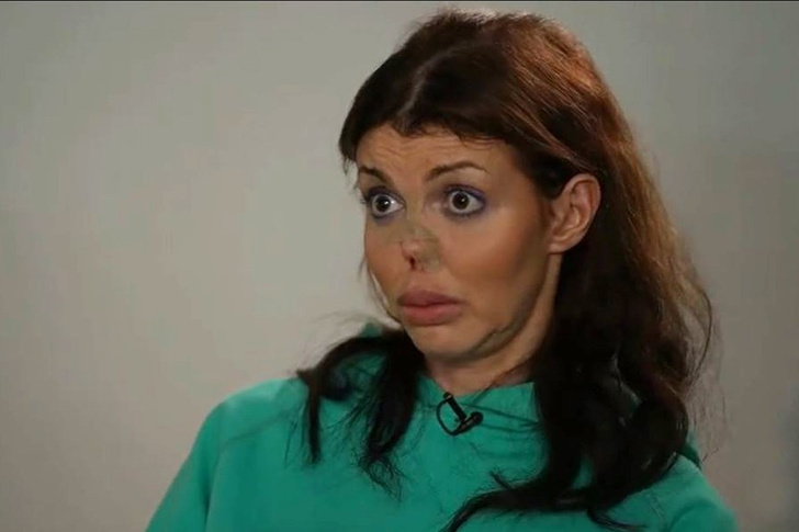 Истощенная сифилисом Алиса Аршавина на грани: «Мама, я жива! У меня есть волосы и нос!»