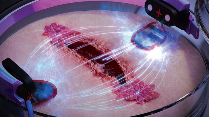 Заживает втрое быстрее: найден способ ускорить лечение ран с помощью электричества