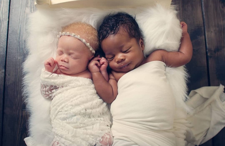 «Я думала, ребенка подменили»: мать родила двойняшек с разным цветом кожи