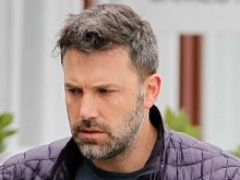 Бен Аффлек стал жертвой неудачной пластики