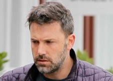 Бен Аффлек стал жертвой неудачной пластики