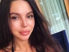 Оксана Самойлова пожаловалась на ужасные отеки во время беременности