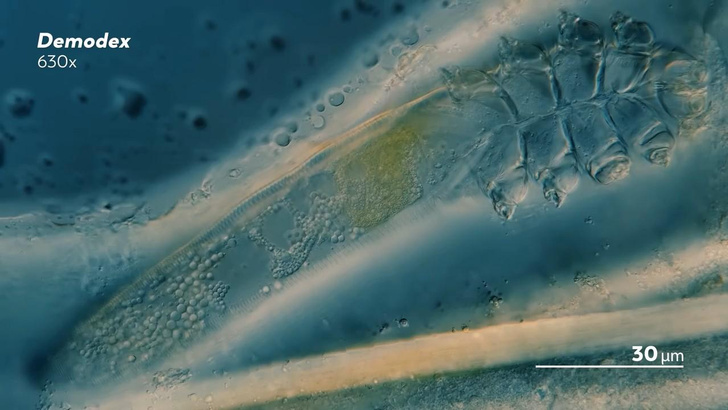 Видео, которое вы не рискнете посмотреть: как выглядят микроскопические клещи на человеческом теле