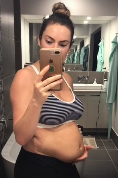 Emily Skye Pregnant