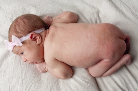 Аллергия у младенцев: как лечить непищевую форму аллергии у новорожденных и  грудничков | WOMAN