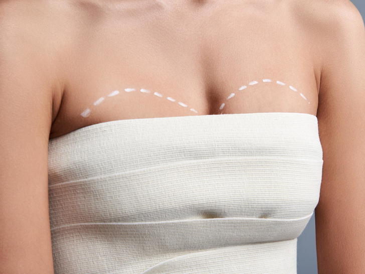 Форма плюс объем: что нужно знать о якорной подтяжке груди