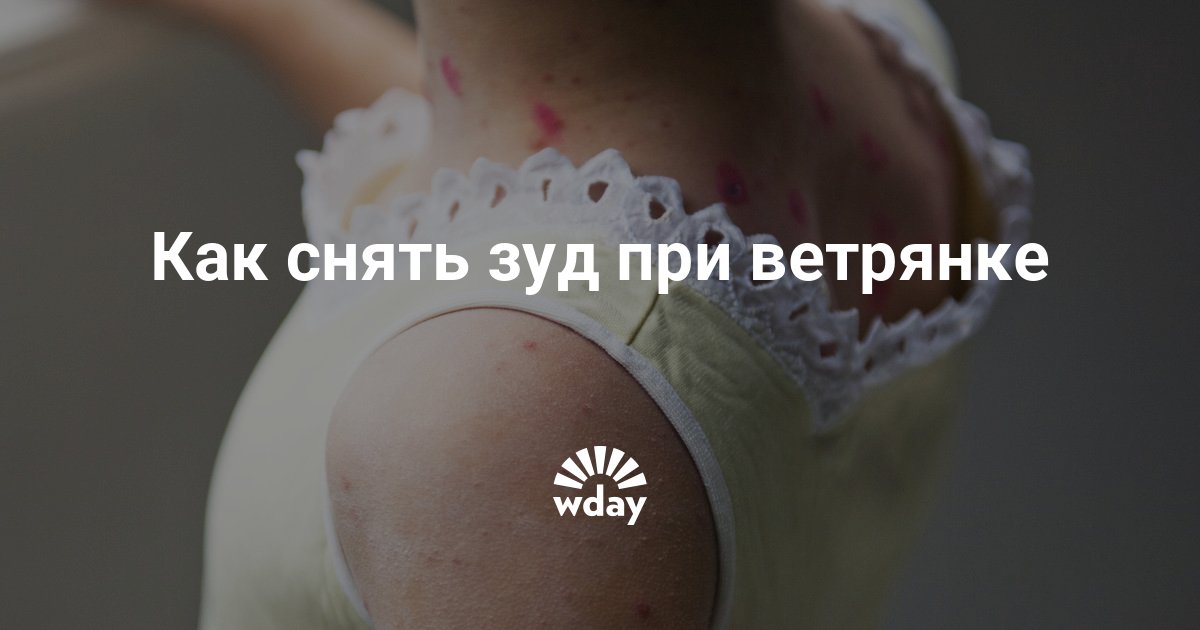 Как, чем можно снять зуд при ветрянке | theDay