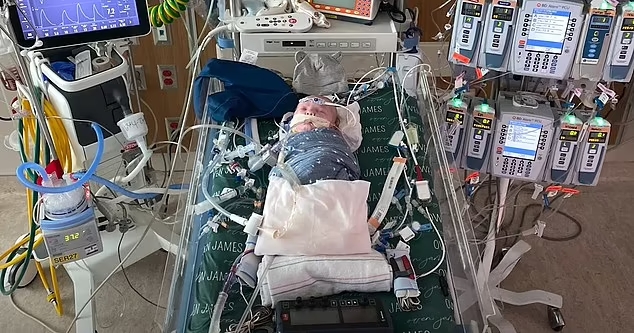 Новое сердце для Оуэна: как хирурги спасли младенца, который родился со сросшимися сосудами