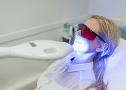 «Какие виды отбеливания зубов лучше и безопаснее?»