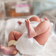 Гинеколог объяснила, почему ребенок может родиться с гидроцефалией