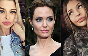 Не хуже Джоли! 10 девушек с шикарными пухлыми губами